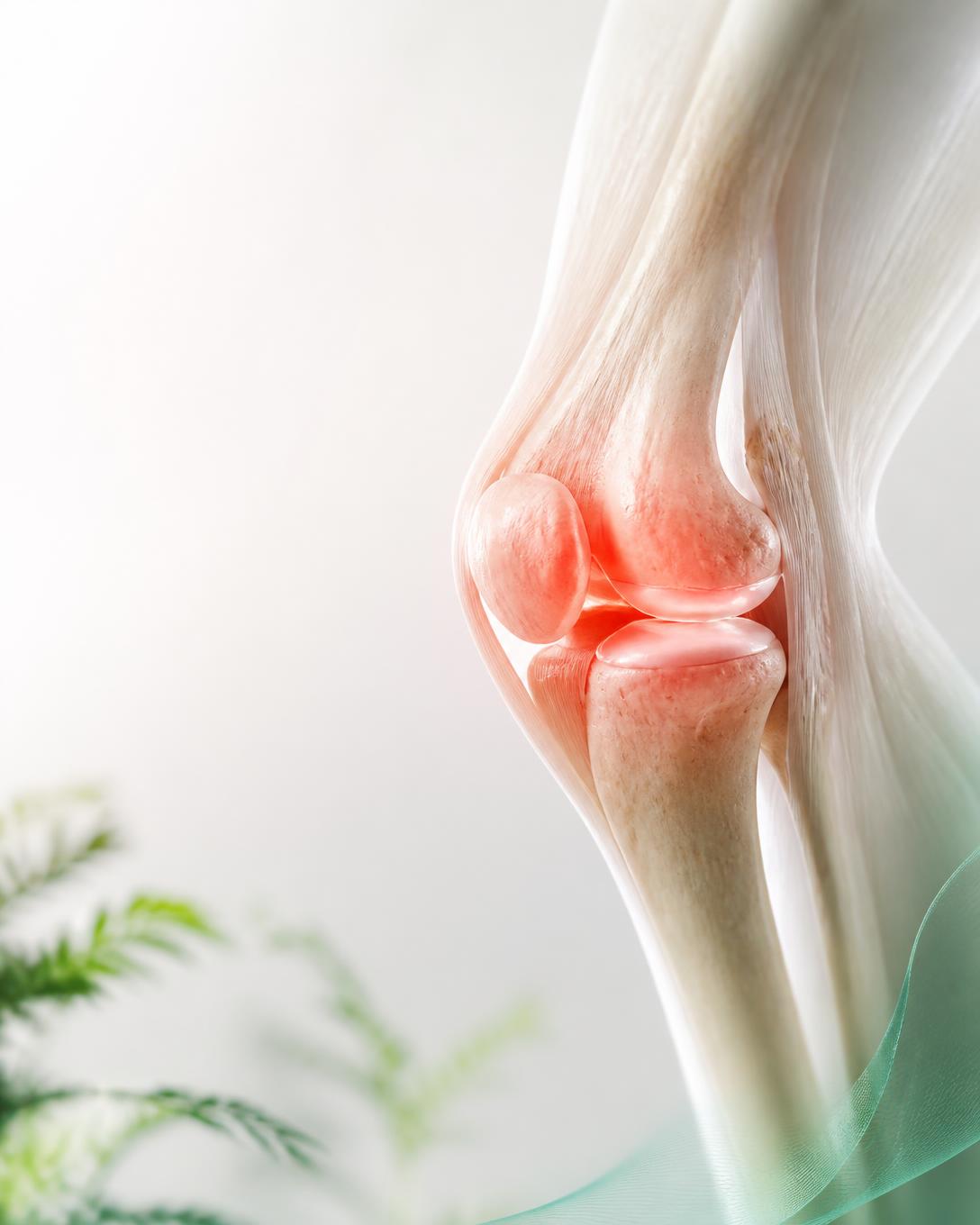 Realistické anatomické zobrazenie zapáleného kolena